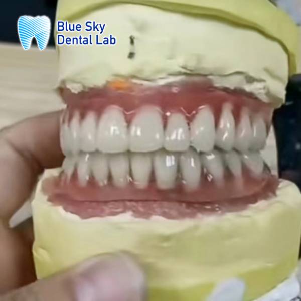 full mouth dental implants service