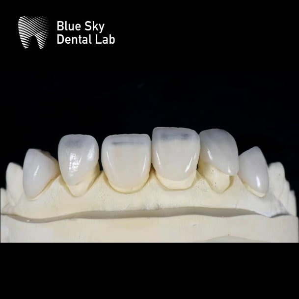 cosmetic dentistry solutions China