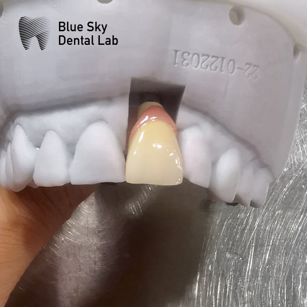 Digital implant service